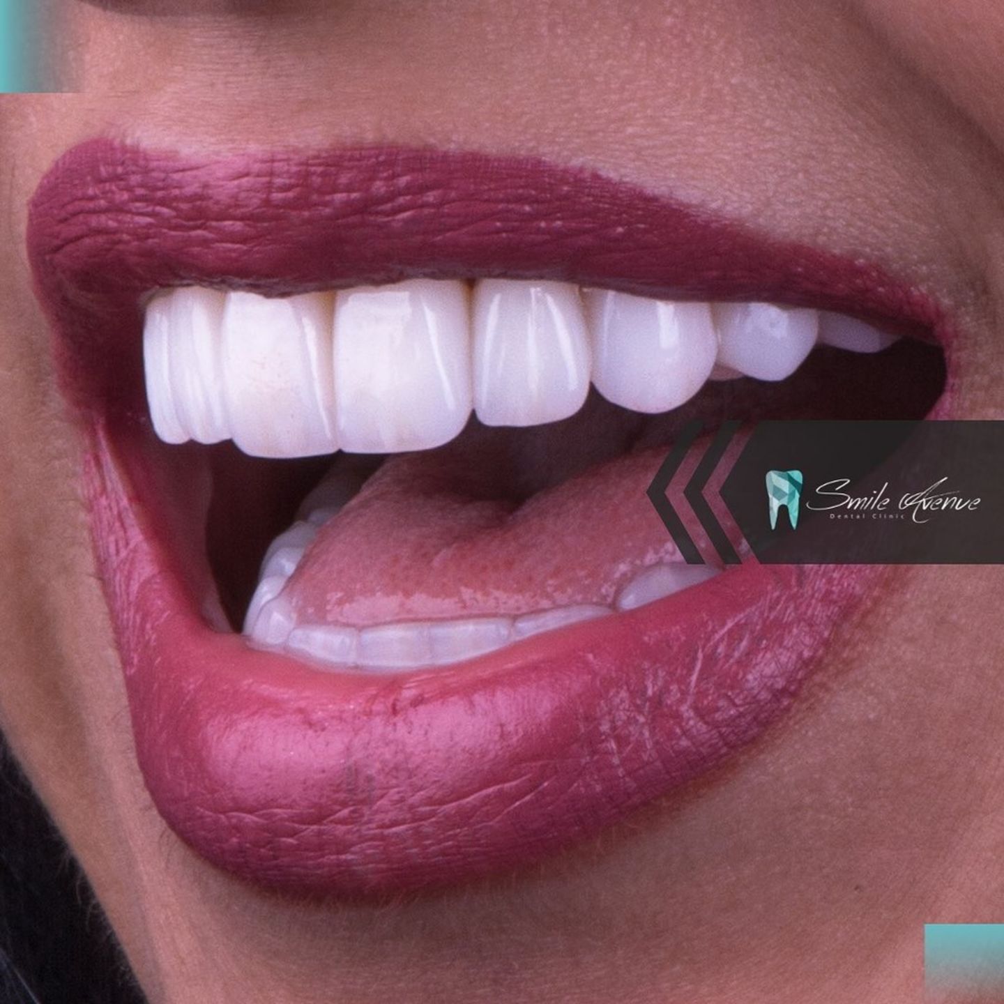 HiDubai-business-smile-avenue-dental-clinic-beauty-wellness-health-hospitals-clinics-business-bay-dubai