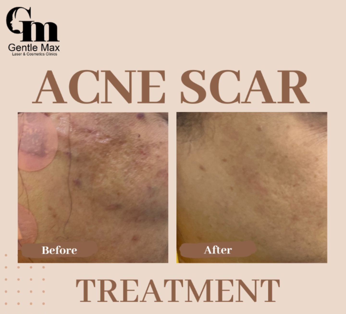 HiDubai-business-gentle-max-clinic-beauty-wellness-health-hospitals-clinics-al-jadaf-dubai