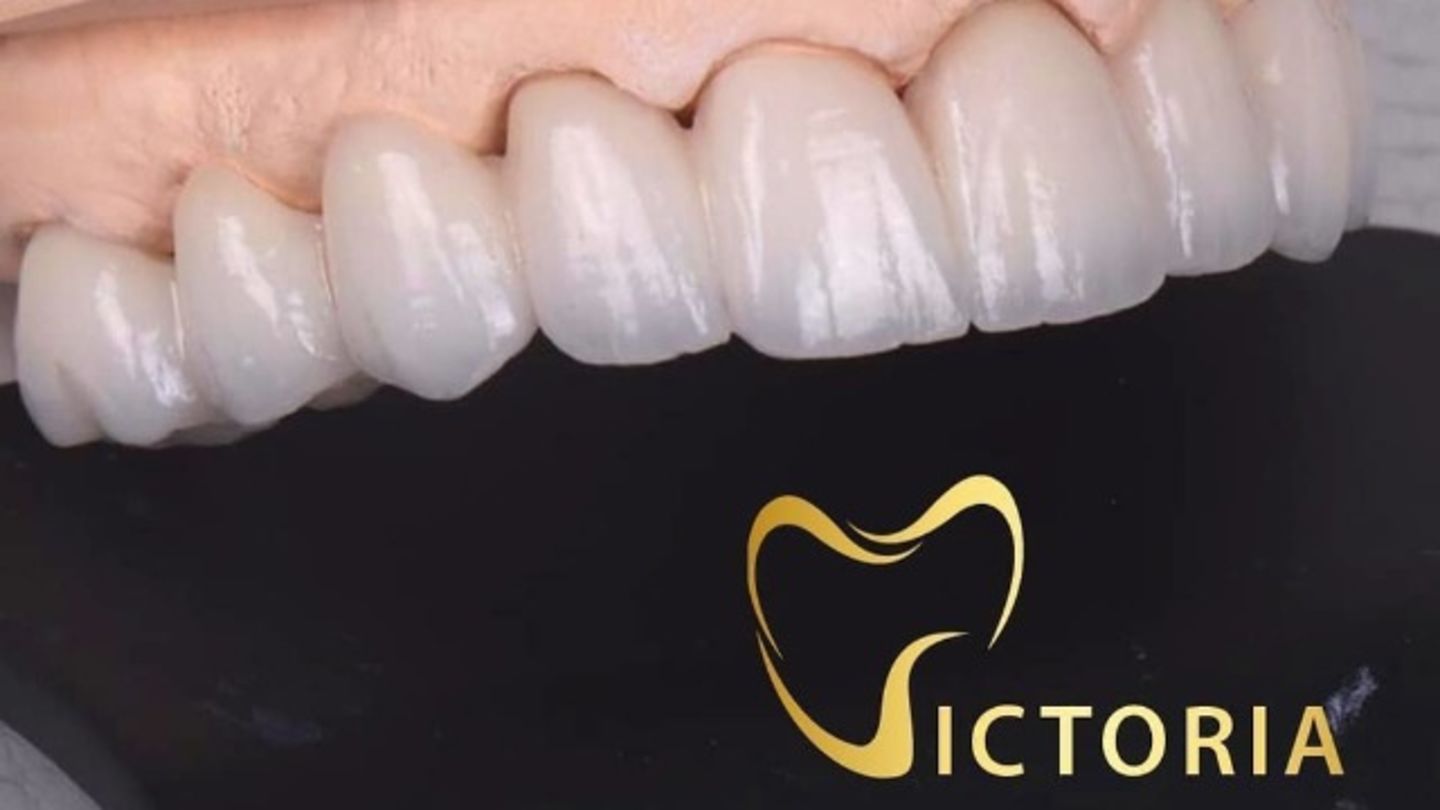 HiDubai-business-victoria-dental-laboratory-beauty-wellness-health-labs-medical-test-centres-al-bada-dubai