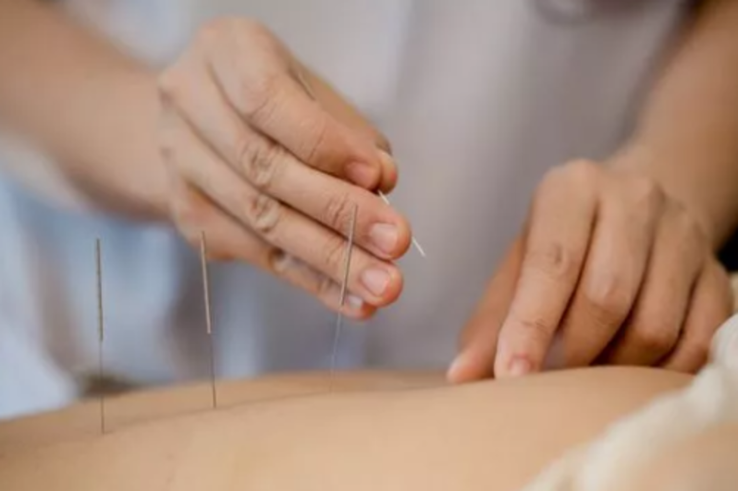 HiDubai-business-tcm-acupuncture-therapy-center-beauty-wellness-health-homeopathy-alternative-medicine-dubai-motor-city-al-hebiah-1-dubai