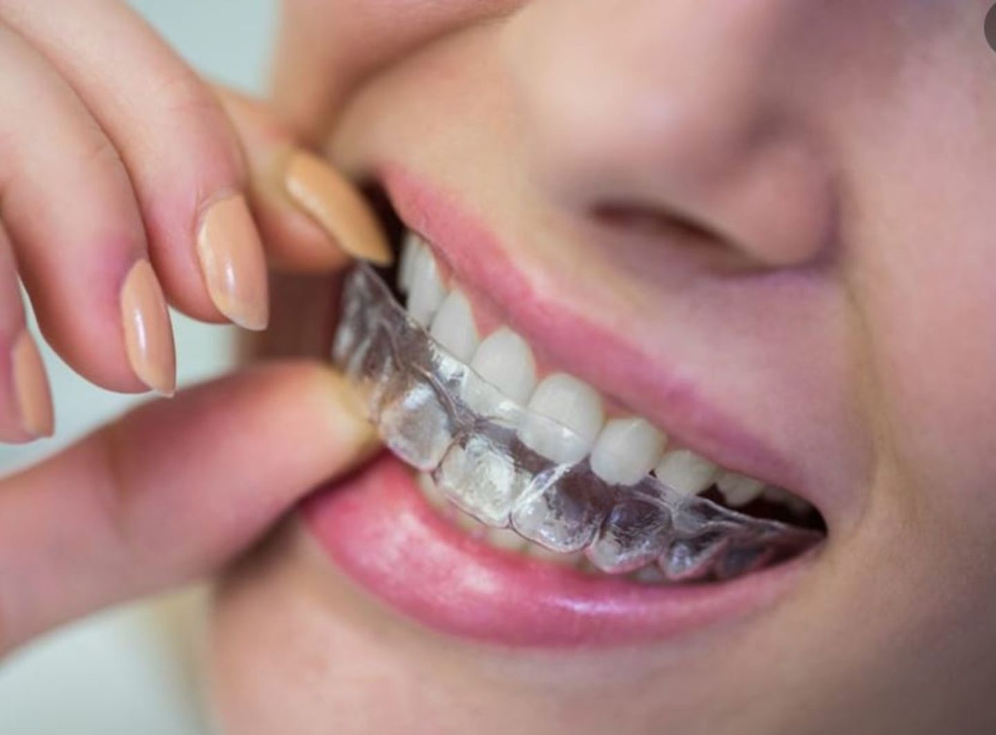 HiDubai-business-brite-medicare-medical-center-beauty-wellness-health-hospitals-clinics-al-nahda-2-dubai