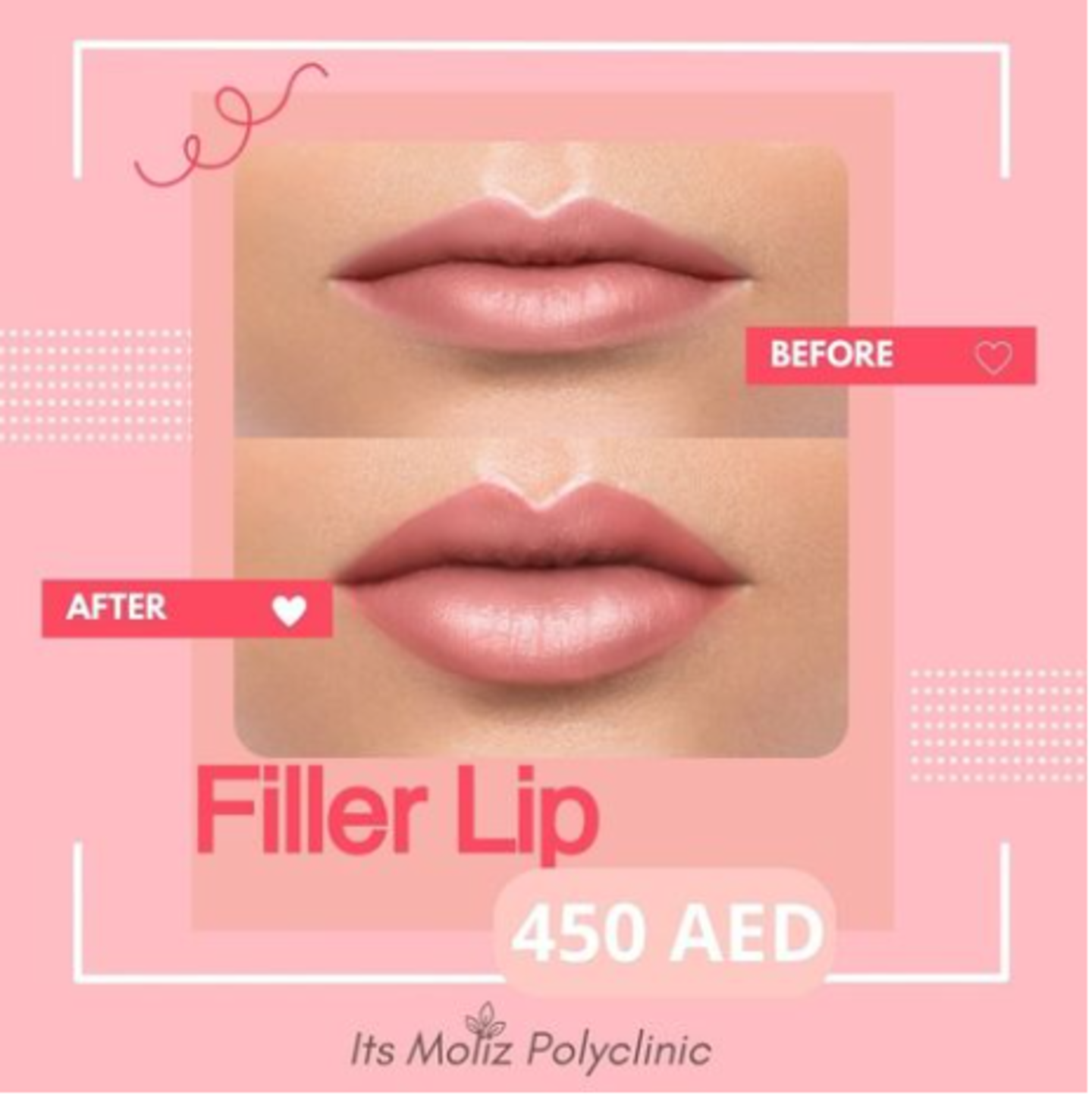 HiDubai-business-moliz-poly-clinic-beauty-wellness-health-specialty-clinics-business-bay-dubai